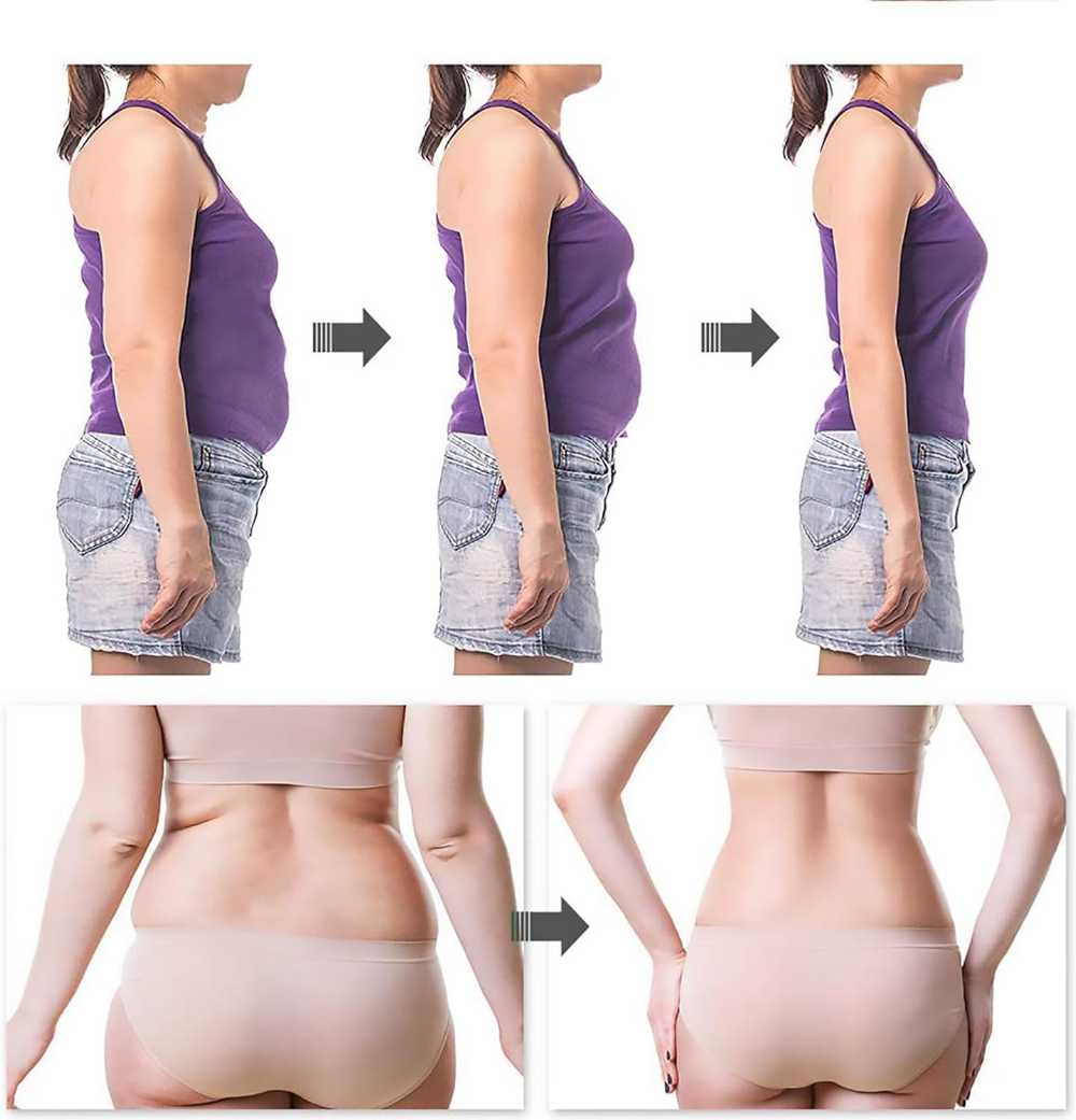 Herbal Slimming Detox Patches – Weight Loss & Body Contouring Navel Stickers (30 Pcs)