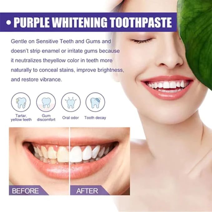 V34 Colour Corrector Toothpaste

Brightening Stain Removal Toothpaste

Instant Teeth Whitening Gel