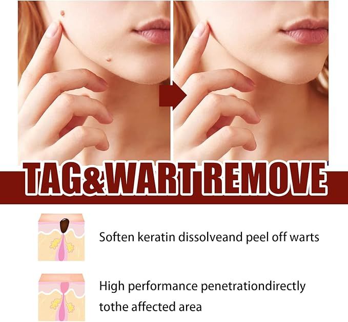 Natural Wart Removal Liquid

Fast Acting Skin Care Tool

Face and Body Mole Remover