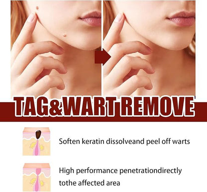 Natural Wart Removal Liquid

Fast Acting Skin Care Tool

Face and Body Mole Remover